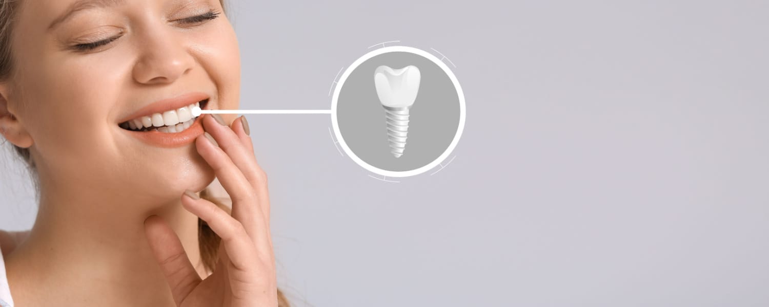 Dental Implants Bloomington, IL