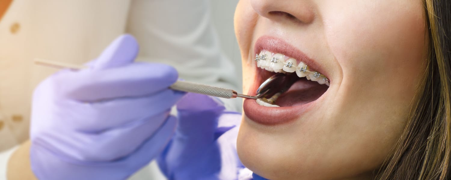 Orthodontist Bloomington, IL